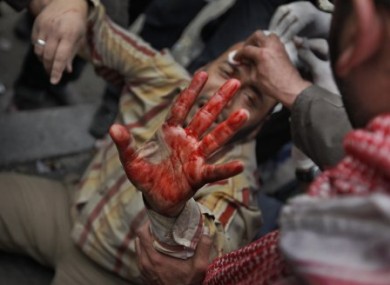 A wounded anti-government protester holds up his bloodied hand in downtown Cairo, Egypt, Thursday, Feb. 3, 2011.