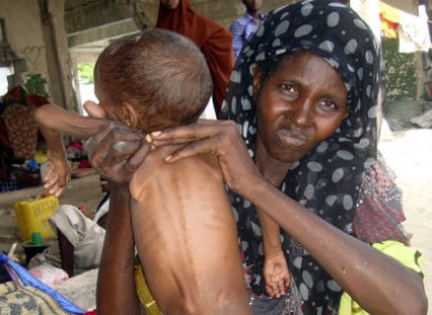 A woman with her malnourished child, in one of the internally displaced camps, in Mogadishu, Somalia, Tuesday, July 5, 2011, after fleeing their homes, due to lack of water and food.