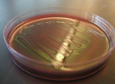 File photo of a sample of E.coli in a Petri dish.