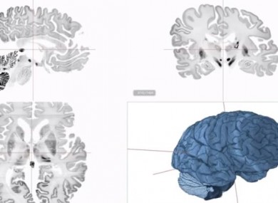 The ultra high resolution scan of the human brain