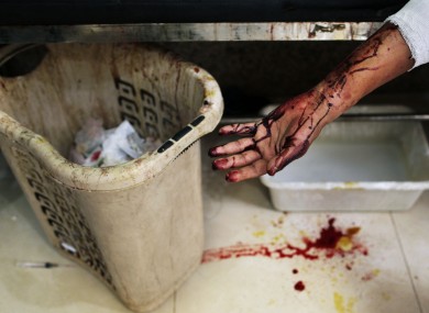 An injured man at a Syrian hospital, September 2012.