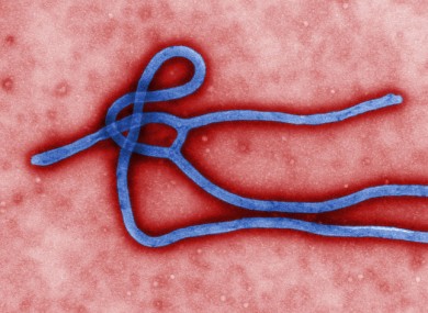 The Ebola virus.