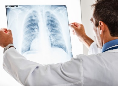 Lung x-ray