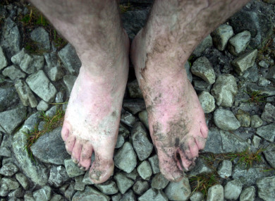 A barefoot pilgrim during the climb of Croagh Patrick.