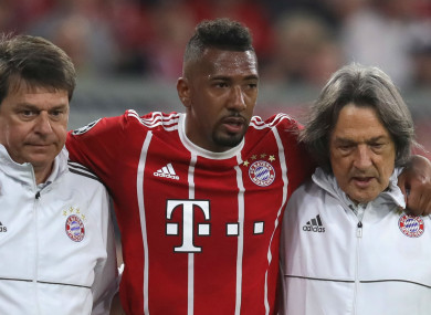 Bayern Munich defender Jerome Boateng went off during the first half of last night's game in Munich.