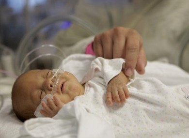 14-week-old Melinda Star Guido lies in an incubator at the Los Angeles County-USC Medical Center in Los Angeles