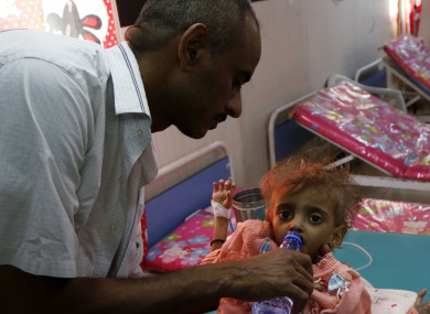 A sick child and her father are seen at a hospital in Hodeidah city, Yemen this week.