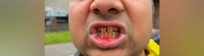 'He's from India': Man allegedly attacked by group of teens after they asked where he was from